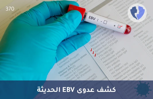 كشف مبكر لفيروس إبشتاين-بار - تحليل الأجسام المضادة لفيروس إبشتاين-بار النوع م (EBV IgM)