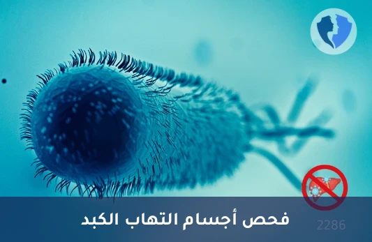 فحص فيروس الكبد الوبائي E - تحليل الأجسام المضادة لفيروس التهاب الكبد الوبائي (HEV)