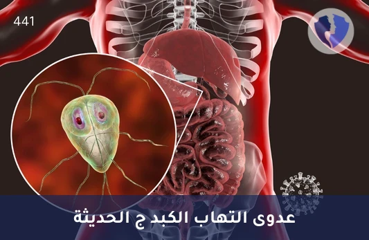 الكشف المبكر عن التهاب الكبد C - تحليل الأجسام المضادة لفيروس التهاب الكبد ج (HCV IgM)