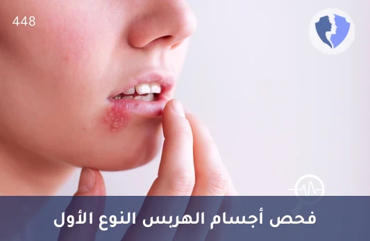 فحص مناعة فيروس الهربس 1 - تحليل الأجسام المضادة لفيروس الهربس البسيط النوع الأول (HSV-1 IgG)