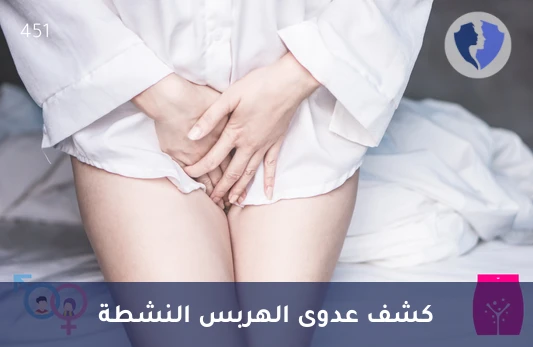 فحص عدوى الهربس النشطة - تحليل الأجسام المضادة لفيروس الهربس البسيط النوع الثاني (HSV II IgM)