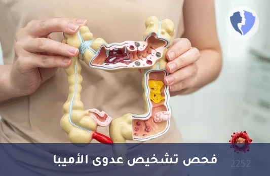 فحص الأجسام المضادة للأميبا - تحليل الأجسام المضادة للأميبا (Amoebiasis Serology)