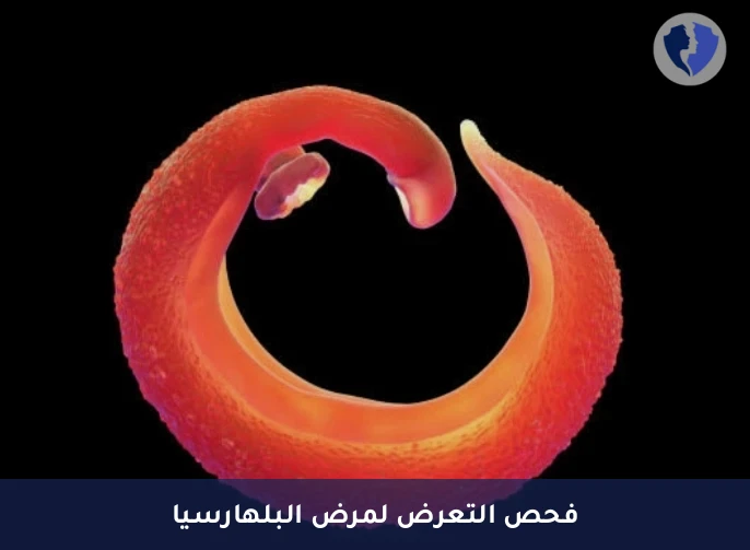 فحص أجسام البلهارسيا المضادة - تحليل الأجسام المضادة للبلهارسيا (Schistosoma IgG)