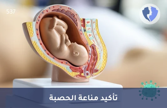 تأكد من مناعتك ضد الحصبة - تحليل الأجسام المضادة للحصبة (Measles IgG)