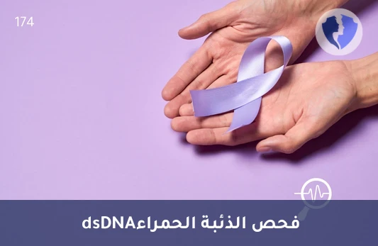 فحص تشخيص الذئبة الحمراء - تحليل الأجسام المضادة للحمض النووي (Anti-dsDNA)