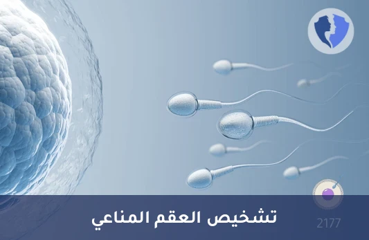 فحص الأجسام المضادة للحيوانات المنوية - تحليل الأجسام المضادة للحيوانات المنوية في المصل (Anti-Sperm Abs)