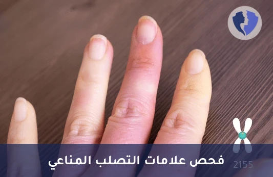 فحص تشخيص تصلب الجلد - تحليل الأجسام المضادة للسنترومير (Anti Centromere Abs)