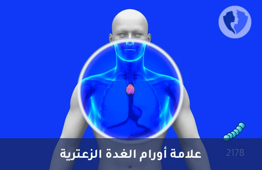 فحص أورام الغدة الزعترية - تحليل الأجسام المضادة للعضلات المخططة (Anti-Striated Muscle Abs)