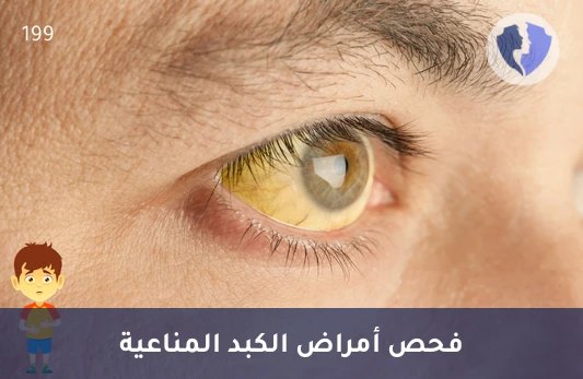 احمِ كبدك من الالتهابات - تحليل الأجسام المضادة للعضلات الملساء (ASMA)