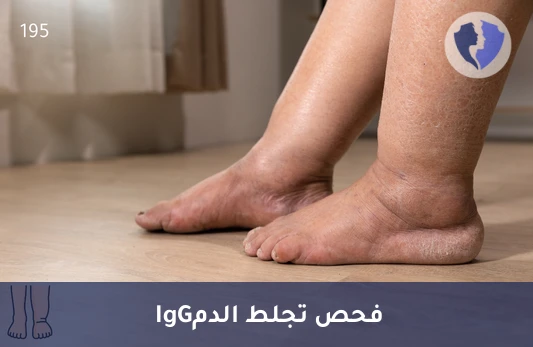 فحص مخاطر تجلط الدم - تحليل الأجسام المضادة للفوسفوليبيد (Anti-Phospholipids IgG)