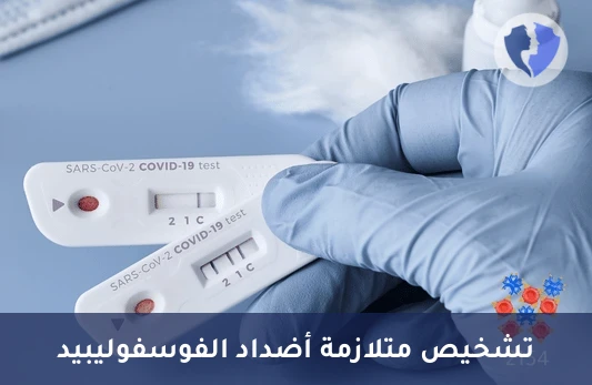 فحص مضادات الكارديوليبين - تحليل الأجسام المضادة للكارديوليبين (Anti Cardiolipin IgM)