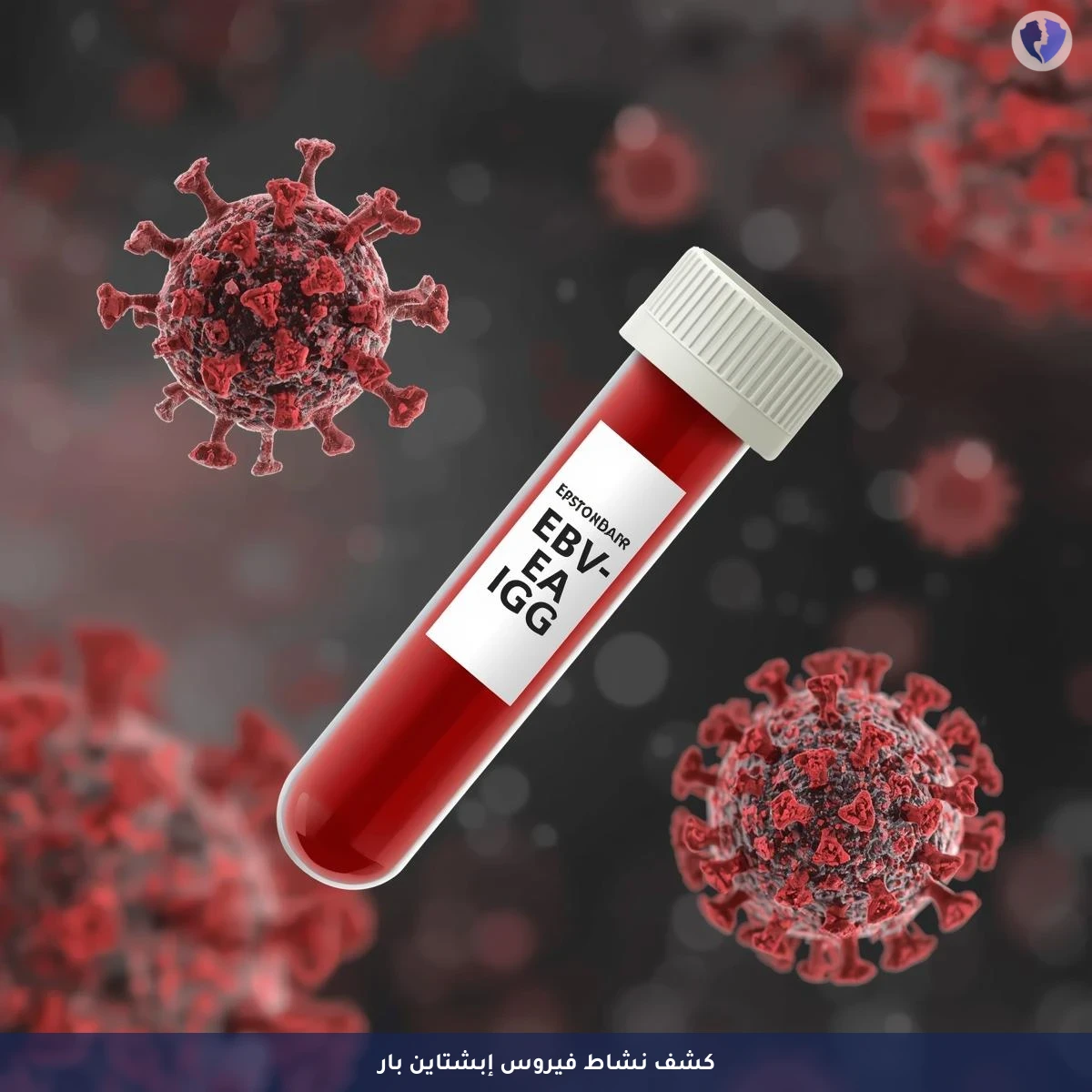 فحص نشاط فيروس إبشتاين-بار - تحليل الأجسام المضادة للمستضد المبكر لفيروس إبشتاين بار (EBV EA IgG)