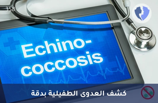 فحص الأجسام المضادة للمشوكات - تحليل الأجسام المضادة للمشوكة في المصل (Echinococcus Abs)