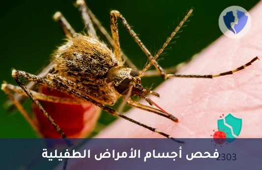 فحص الأجسام المضادة للملاريا - تحليل الأجسام المضادة للملاريا (Malaria Antibodies)