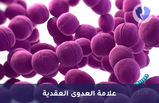 كشف عدوى المكورات العقدية - تحليل الأجسام المضادة للهيالورونيداز العقدية (ASH)