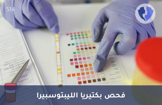 فحص المناعة ضد الليبتوسبيرا - تحليل الأجسام المضادة لليبتوسبيرا (Leptospiral IgG)