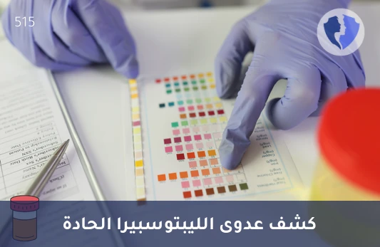 كشف عدوى الليبتوسبيرا النشطة - تحليل الأجسام المضادة لليبتوسبيرا (Leptospiral IgM)