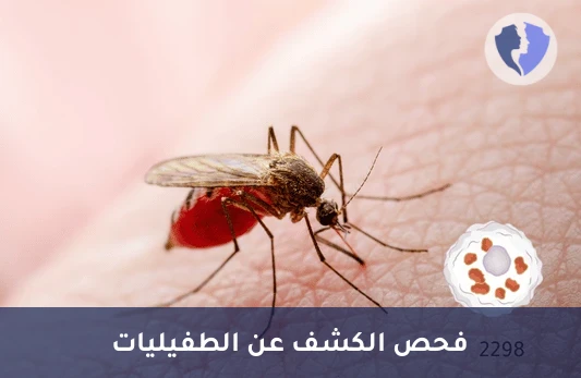 فحص الأجسام المضادة لليشمانيا - تحليل الأجسام المضادة لليشمانيا (Leishmania Antibody - IFA)