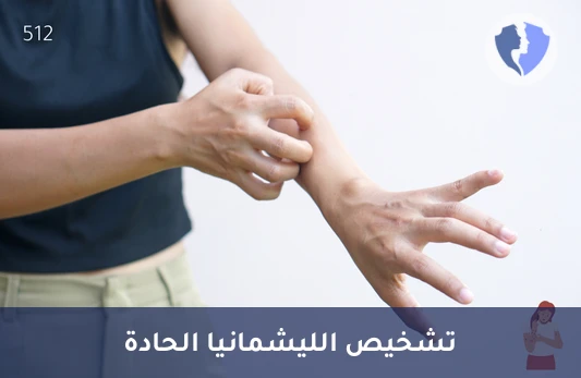 فحص الليشمانيا المبكر - تحليل الأجسام المضادة لليشمانيا (Leishmania IgM)