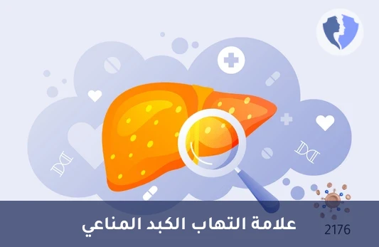 فحص التهاب الكبد المناعي - تحليل الأجسام المضادة لمستضد الكبد الذائب (Anti-SLA)
