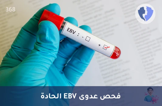فحص عدوى إبشتاين-بار الحديثة - تحليل الأجسام المضادة لمستضد غلاف فيروس إبشتاين-بار النوع م (EBV-VCA IgM)