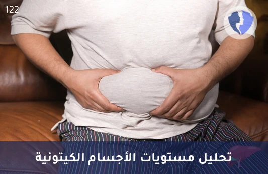 فحص توازن الأجسام الكيتونية - تحليل الأسيتو أسيتات (Acetoacetate)