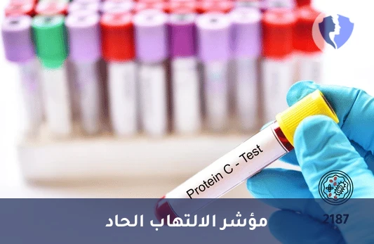 تحليل مؤشر الالتهاب CRP - تحليل البروتين التفاعلي (CRP)