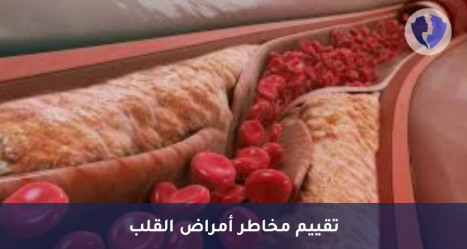 تحليل الكوليسترول الضار جداً - تحليل البروتين الدهني منخفض الكثافة جداً (VLDL)