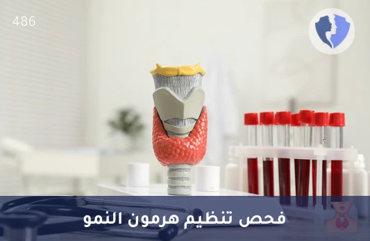 فحص تنظيم هرمون النمو - تحليل البروتين الرابط لعامل النمو الشبيه بالأنسولين 3 (IGFBP3)