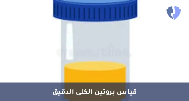 فحص تسرب بروتين البول الشامل - تحليل البروتين الكلي في البول خلال 24 ساعة (Total Protein 24h)