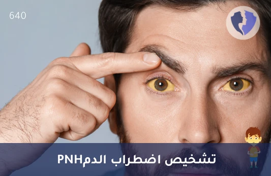 فحص حماية خلايا الدم - تحليل البيلة الهيموجلوبينية الليلية الانتيابية (PNH) (CD55 & CD59)