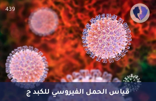فحص الحمل الفيروسي للكبد C - تحليل الحمل الفيروسي لفيروس التهاب الكبد ج (HCV RNA PCR)