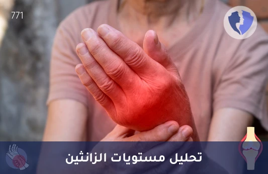 فحص مستويات الزانثين الدقيق - تحليل الزانثين (Xanthine)