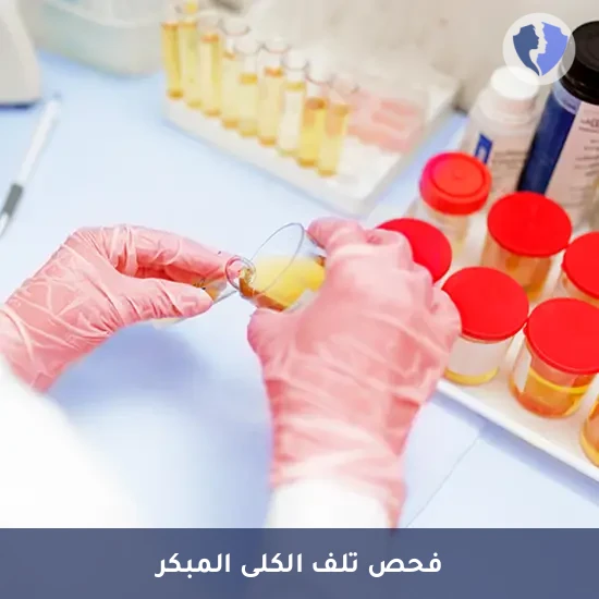 فحص الميكروألبومين في البول - تحليل الزلال الدقيق في البول (Microalbumin)