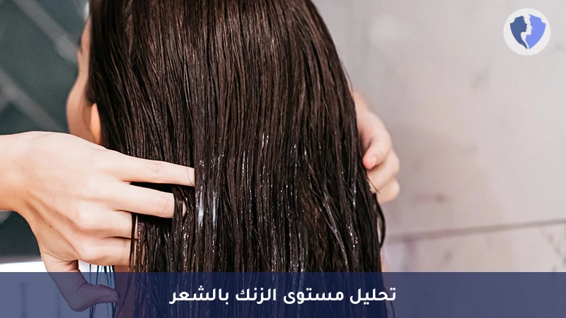 تحليل الزنك في الشعر