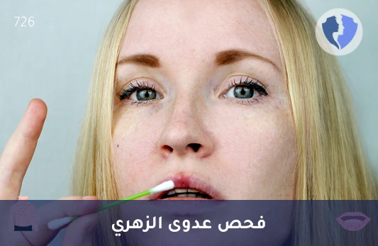 فحص دقيق لعدوى الزهري - تحليل الزهري (TPHA)