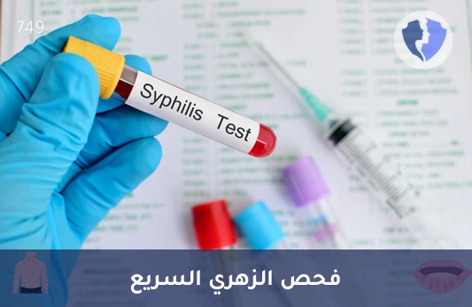 فحص الزهري المبكر والدقيق - تحليل الزهري (VDRL)