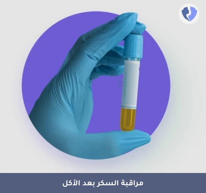 فحص السكر بعد الأكل بساعتين - تحليل السكر بعد الأكل بساعتين (2HPP)