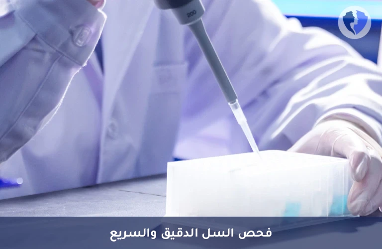 فحص السل بتقنية PCR - تحليل السل بتقنية (PCR)