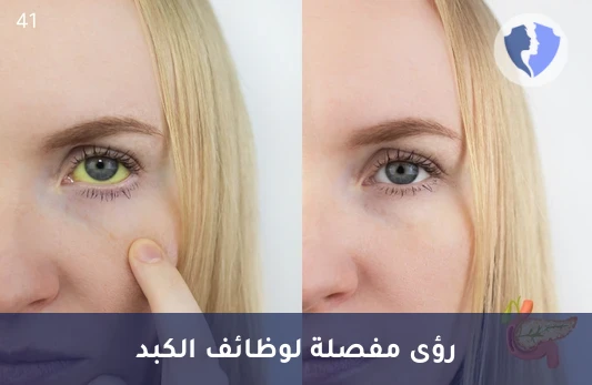 فحص كفاءة تصريف الكبد - تحليل الصفراء المباشر (Direct Bilirubin)