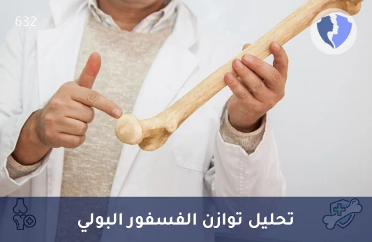 فحص الفسفور في البول - تحليل الفسفور في البول (Phosphorus)