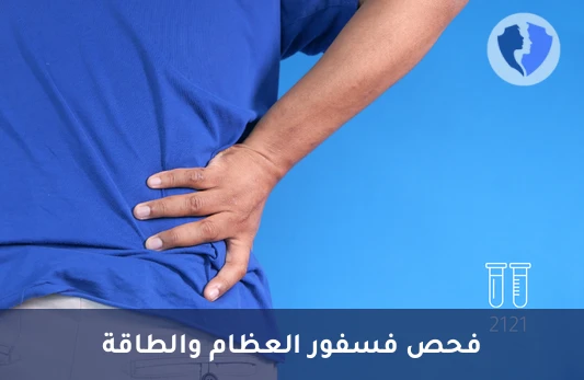 فحص الفسفور لصحة العظام - تحليل الفسفور في المصل (Phosphorus)