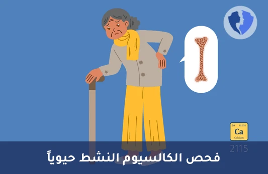 فحص الكالسيوم المتأين النشط - تحليل الكالسيوم المتأين (Ionized Calcium)