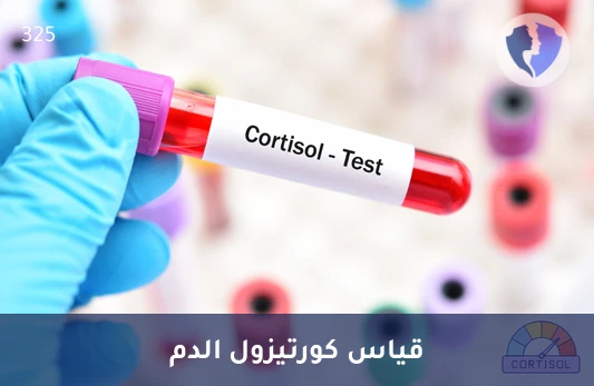 توازن الهرمونات وصحة الغدة الكظرية - تحليل الكورتيزول في الدم (Cortisol)
