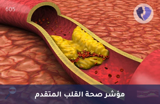 فحص حماية وصحة القلب - تحليل الكوليسترول منخفض الكثافة المؤكسد (OxLDL)