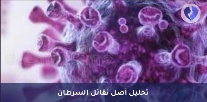 تحديد مصدر الأورام الثانوية - تحليل الكيمياء النسيجية المناعية لبروتين (CDX2)