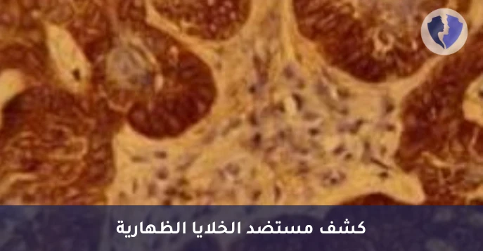 فحص BerEP4 للكشف عن الخلايا السرطانية - تحليل الكيمياء النسيجية المناعية لمستضد (BerEP4)