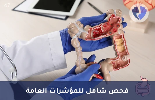 فحص دلالات الأورام المبكر - تحليل المستضد السرطاني المضغي (CEA)