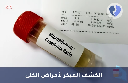 الكشف المبكر عن زلال البول - تحليل الميكروألبومين في البول (Microalbuminuria)