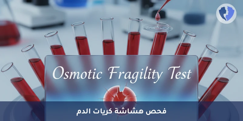 فحص هشاشة خلايا الدم - تحليل الهشاشة الأسموزية لكريات الدم الحمراء (Osmotic Fragility)